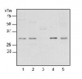 RPL2 | Ribosomal protein L2 (chloroplastic)